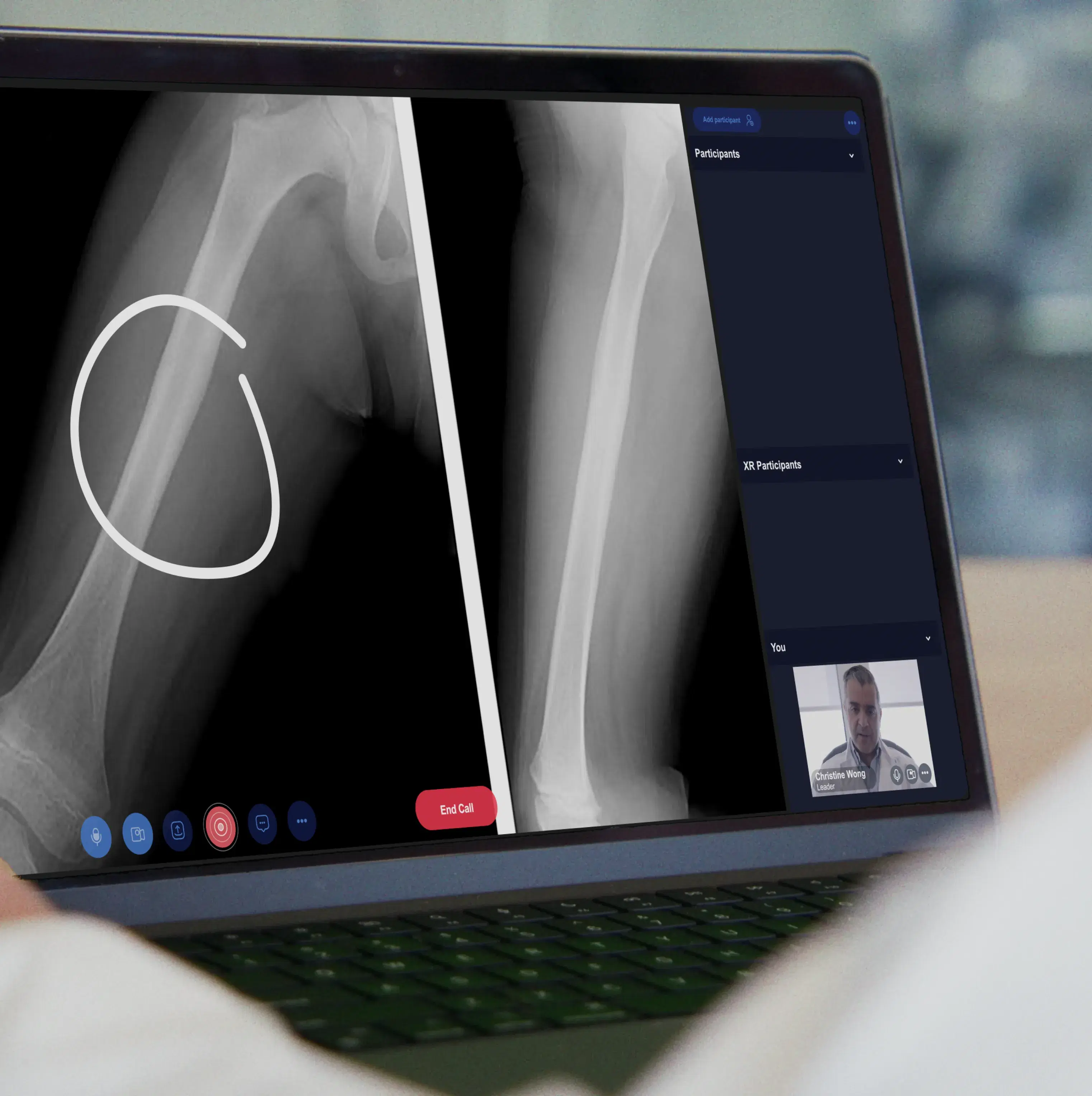 HoloXR collaboration workspace on a clinical laptop